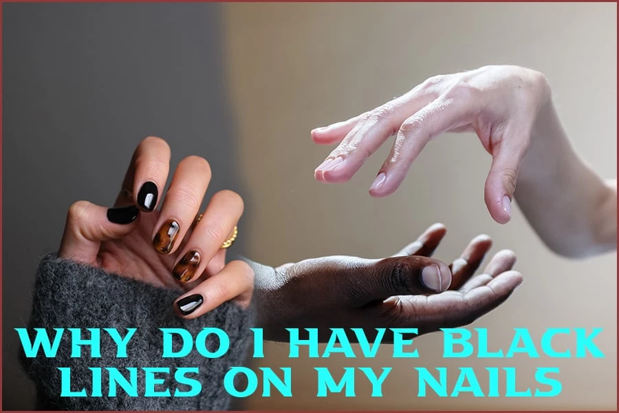 Why Do I Have Black Lines On My Nails: Causes And Treatments