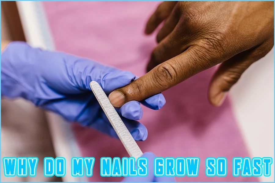 Why Do My Nails Grow So Fast? - The Truth About Nails And How To Fix Them!