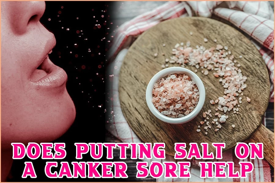 Does Putting Salt On A Canker Sore Help? The Mocracy